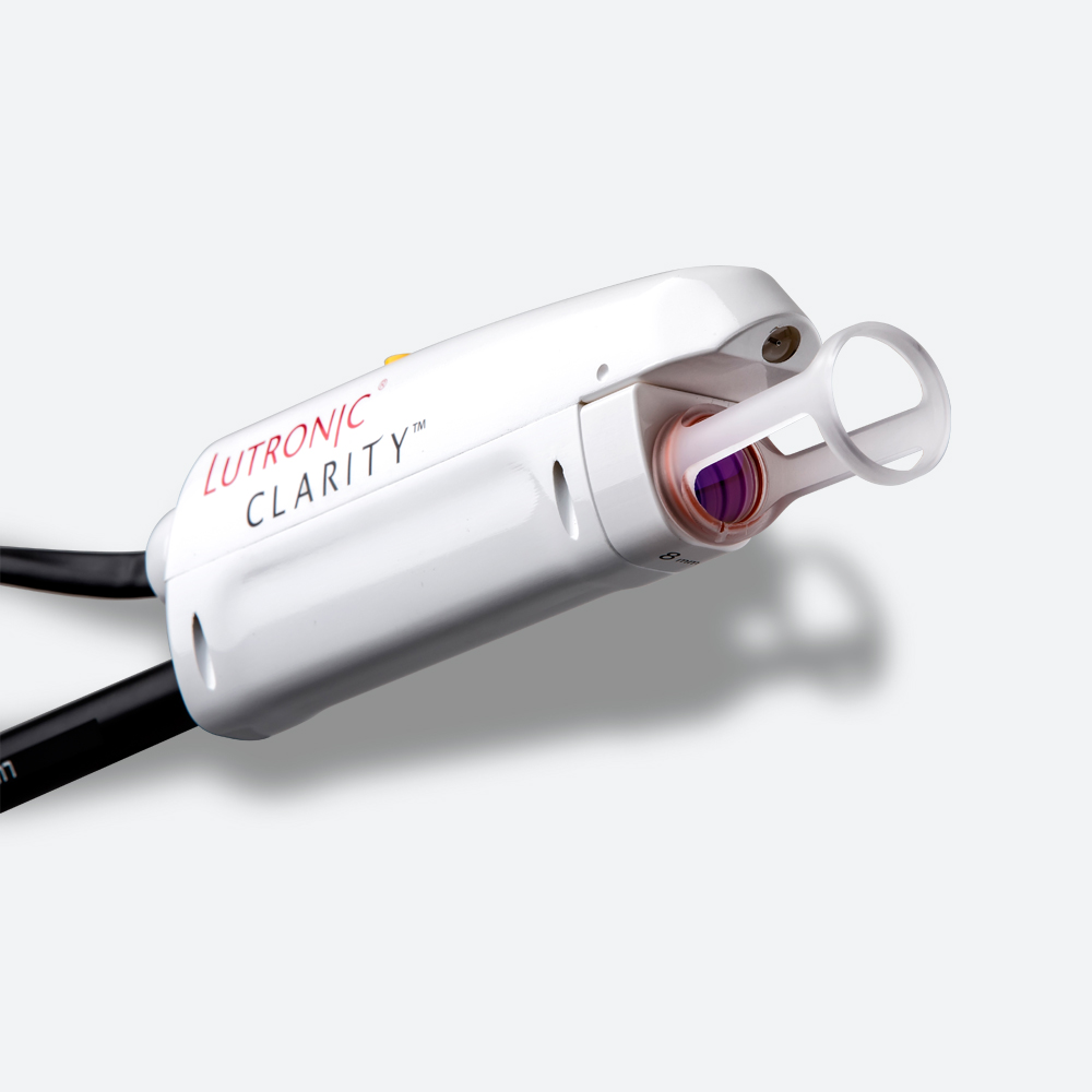 Clarity Alex laser