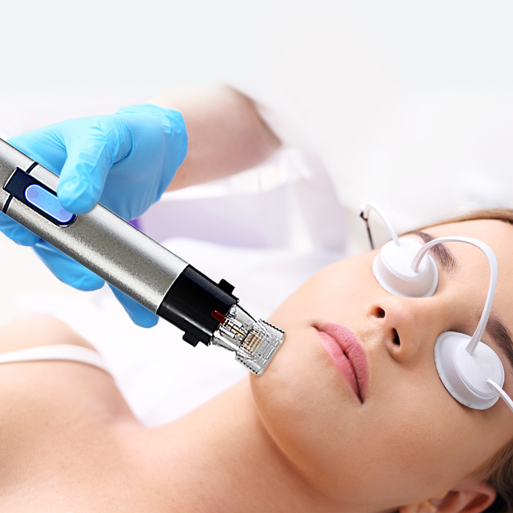 Genius microneedling RF